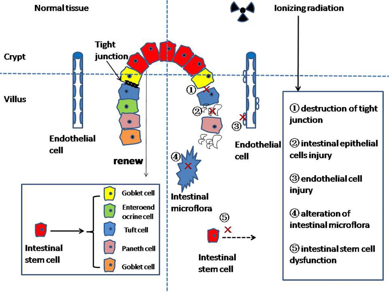 Enteritis