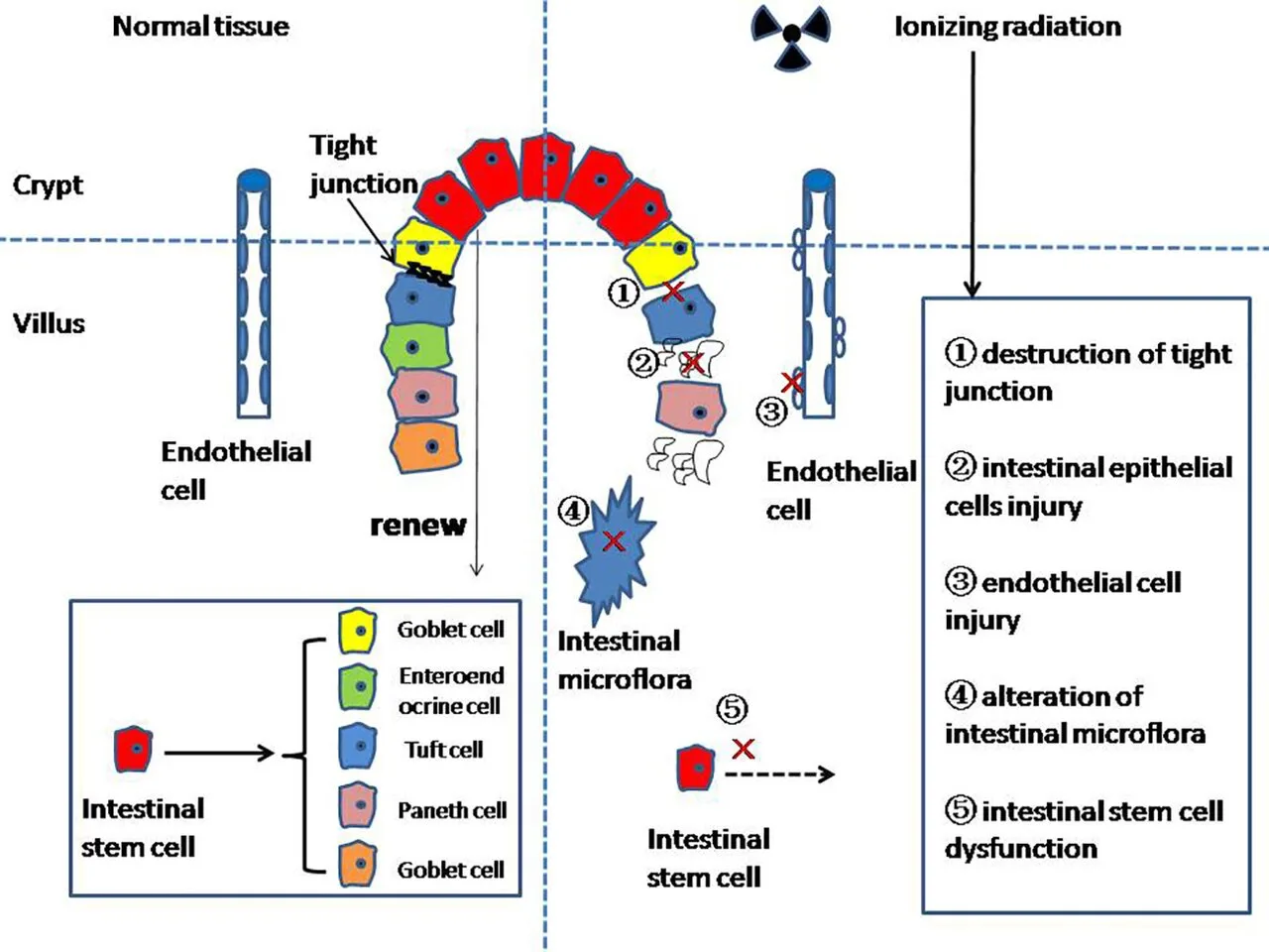 Enteritis