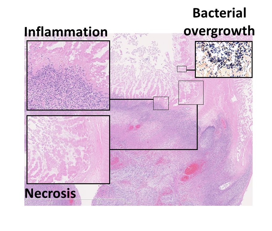 Enterocolitis