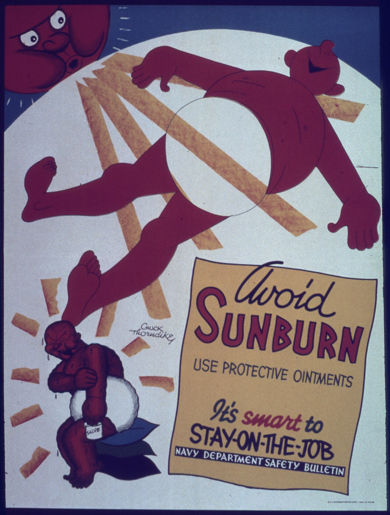 Sunburn