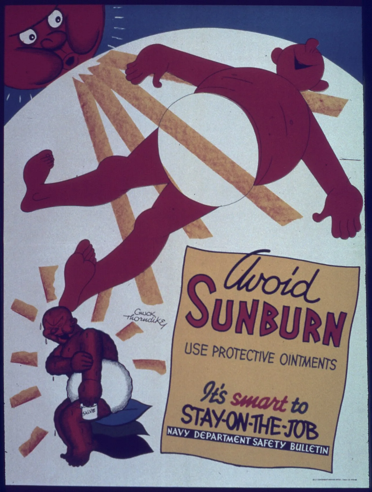 Sunburn