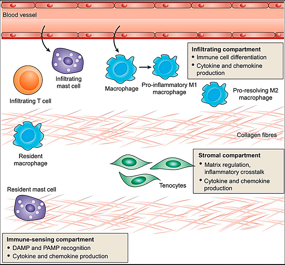 Tendinopathy