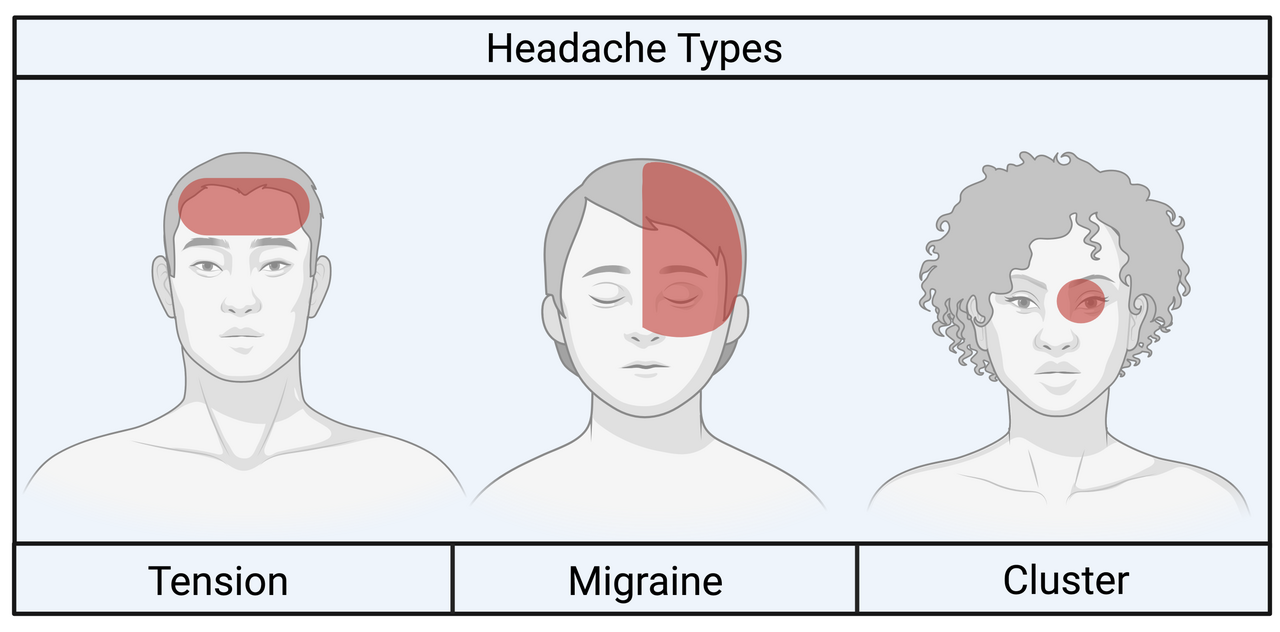 Tension headache