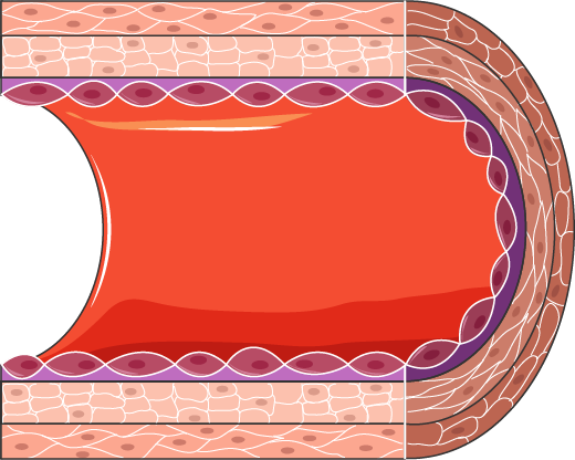 Thrombosis