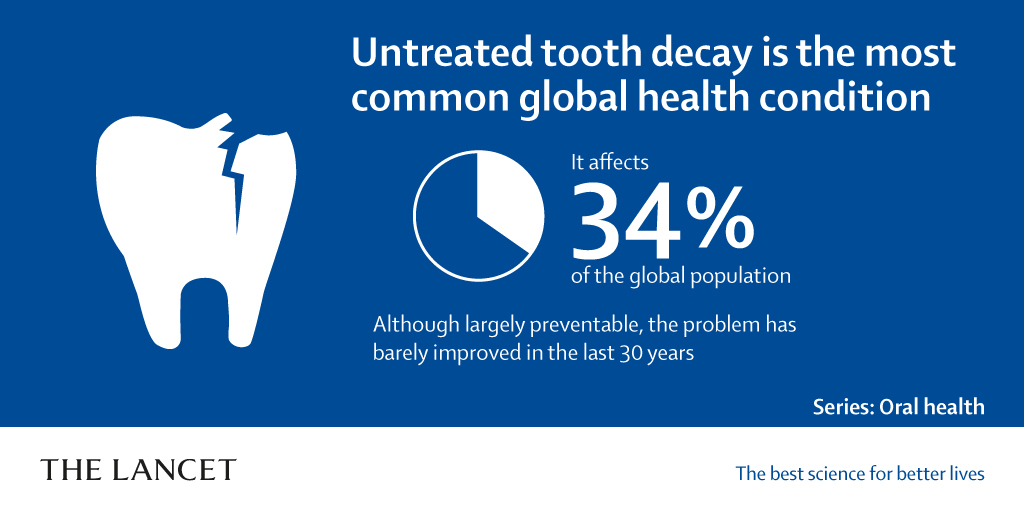 Tooth decay