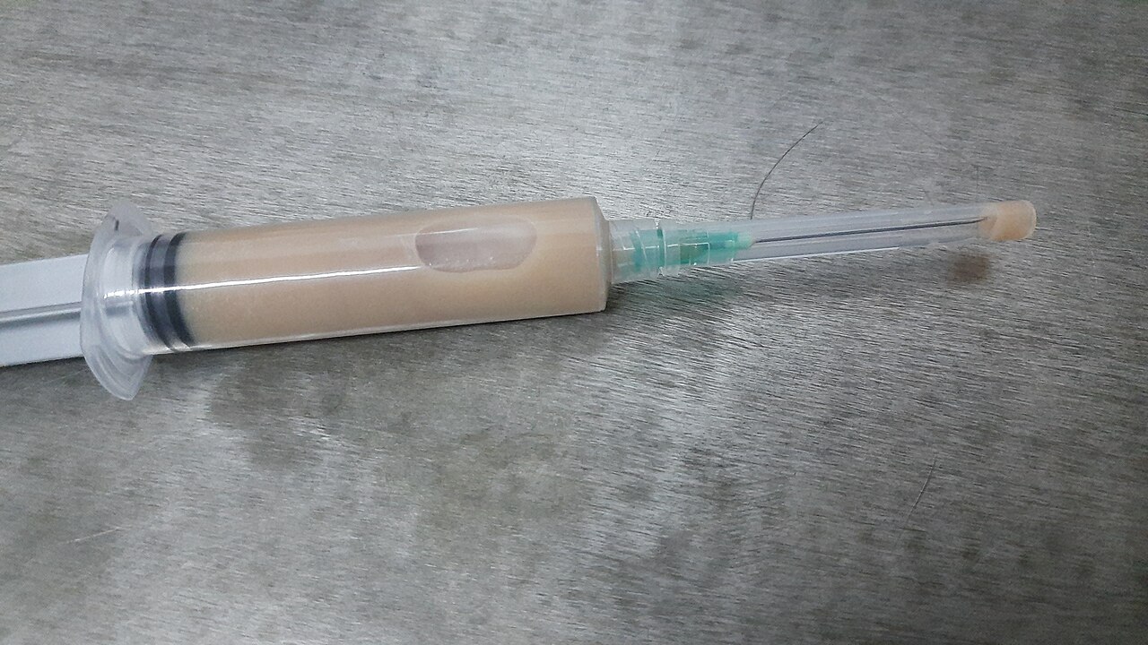 Wound