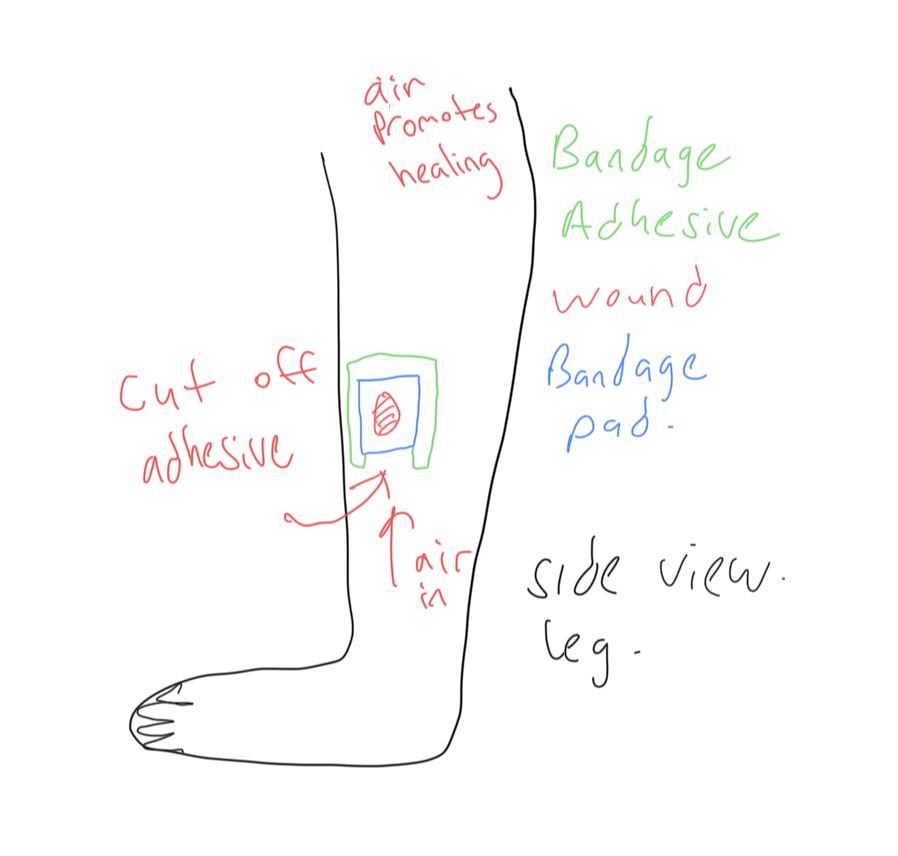 Wound