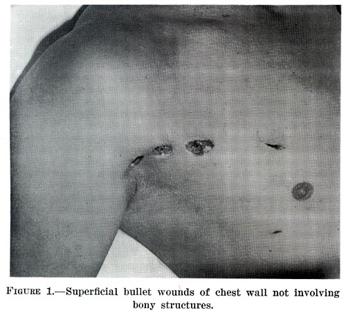 Wound