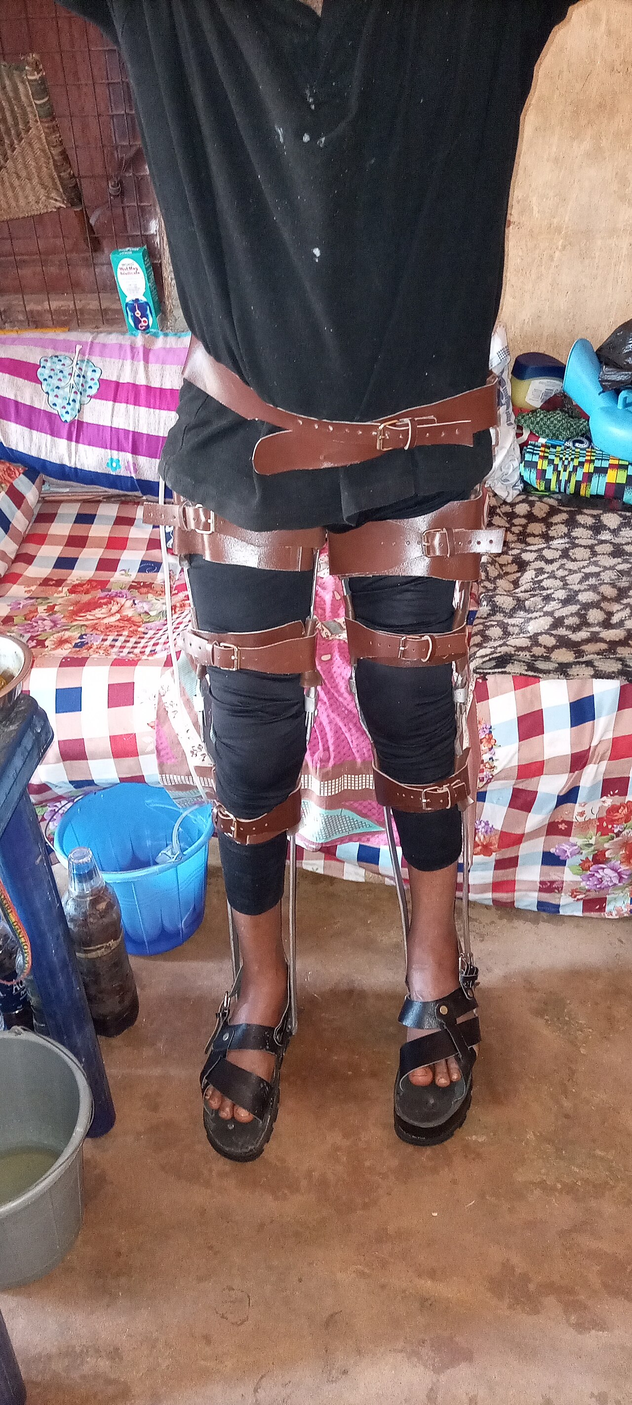 Community Rehabilitation of Spinal Cord Injury