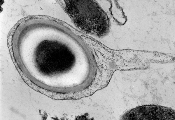 Electron micrograph of endospore of the bacterium Carboxydothermus hydrogenoformans