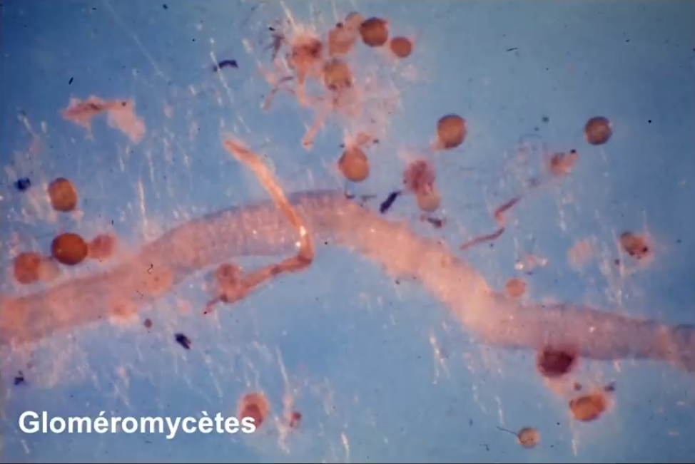 Glomeromycètes (hyphe et spores)