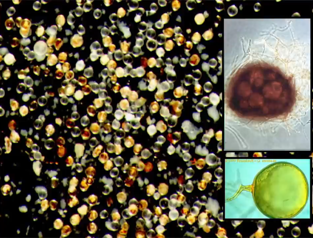 Glomeromycètes (spores)