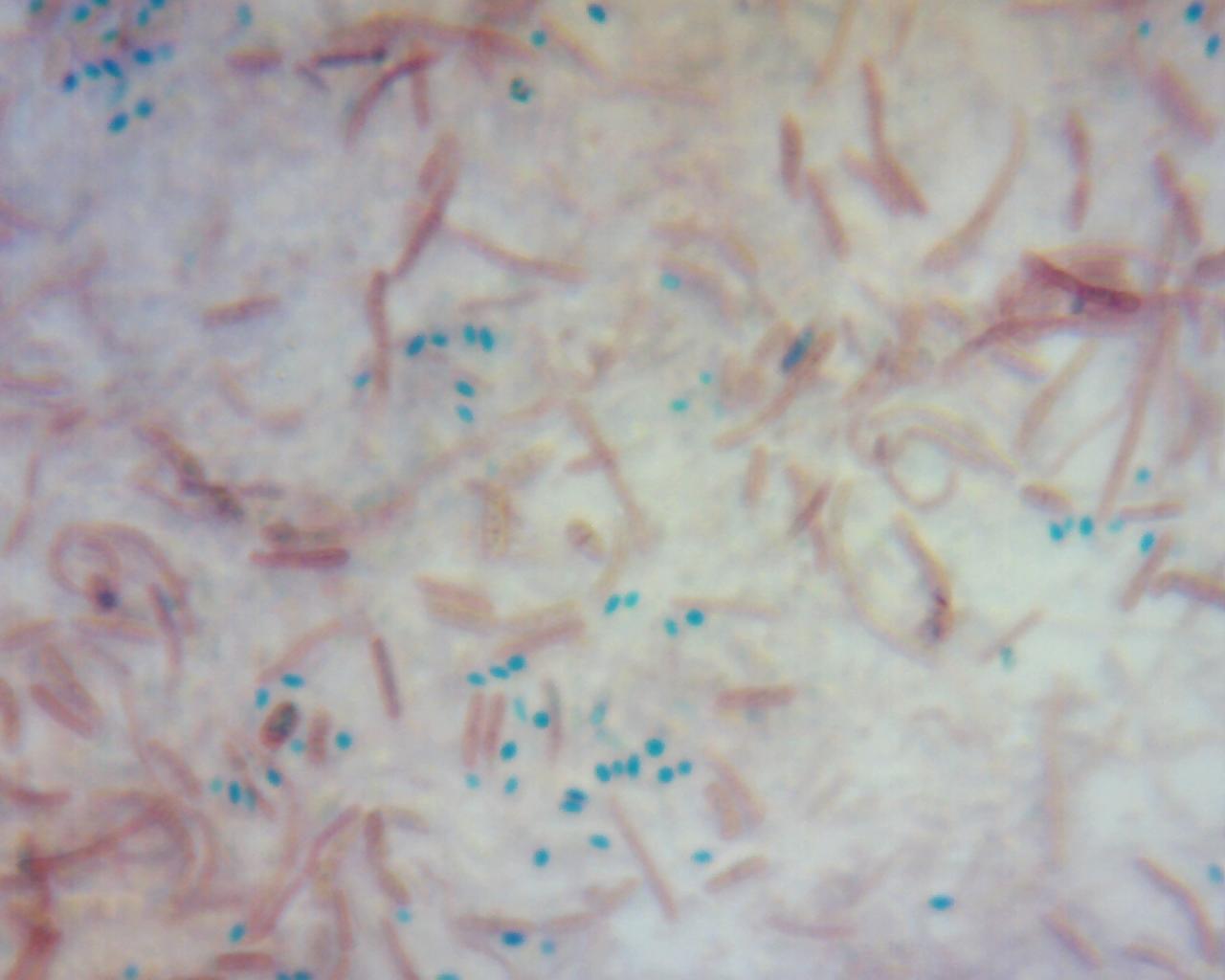 Endospore staining
