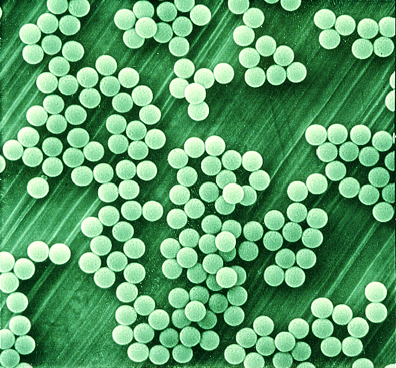 Dynabeads