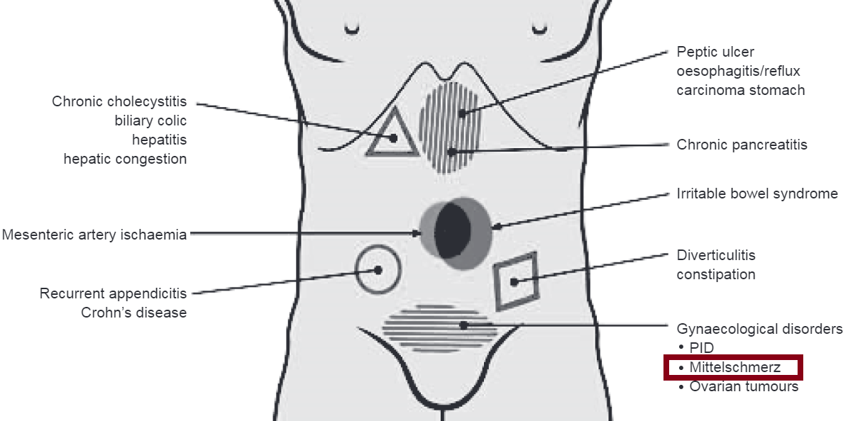 Abdominal pain