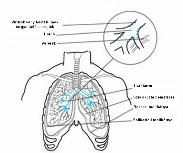 Acute (medicine)