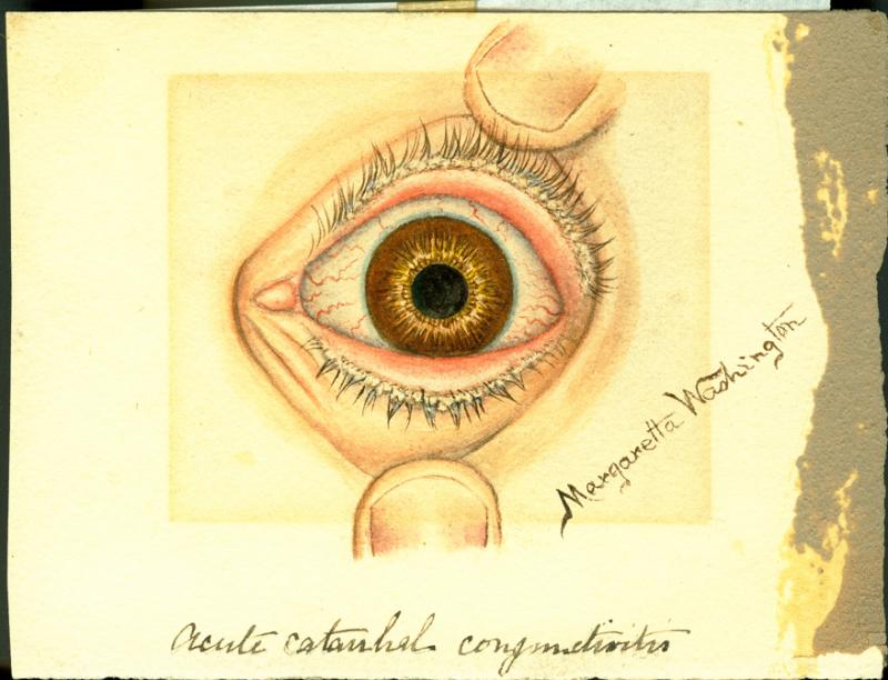 Acute (medicine)