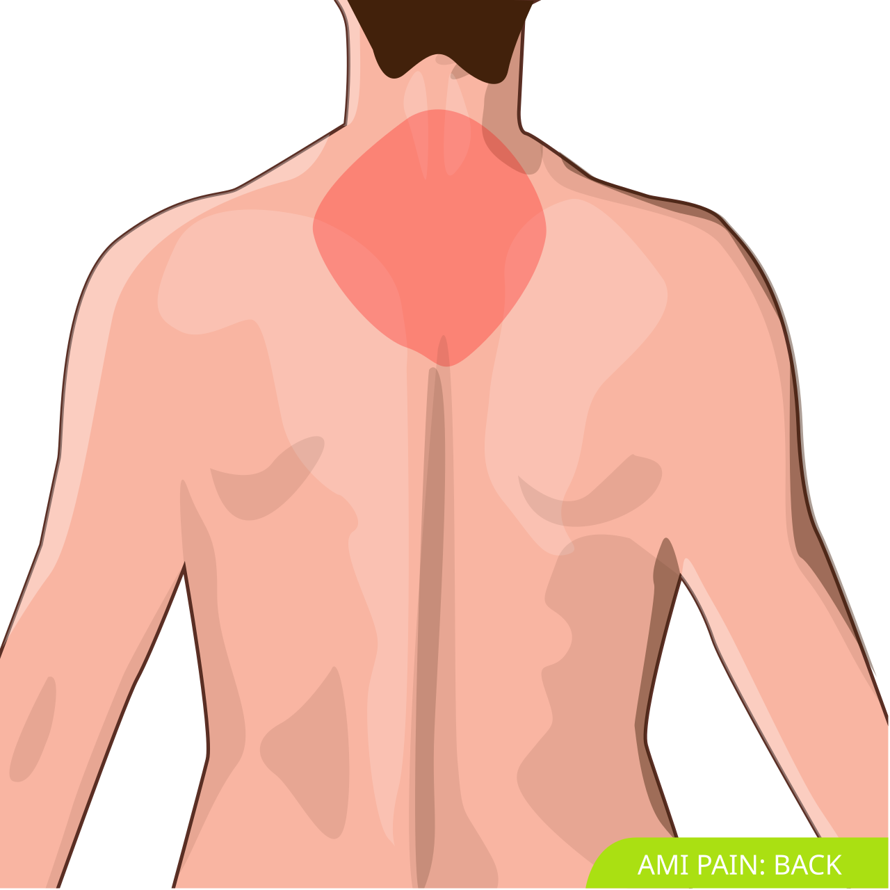 Back pain