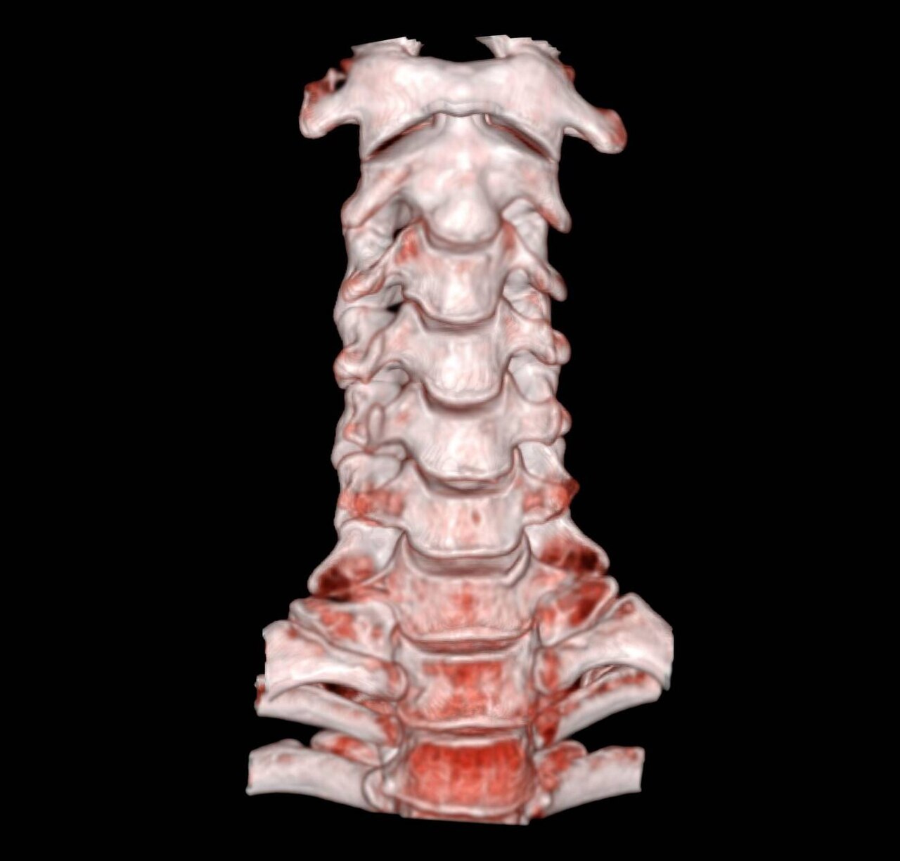 Back pain