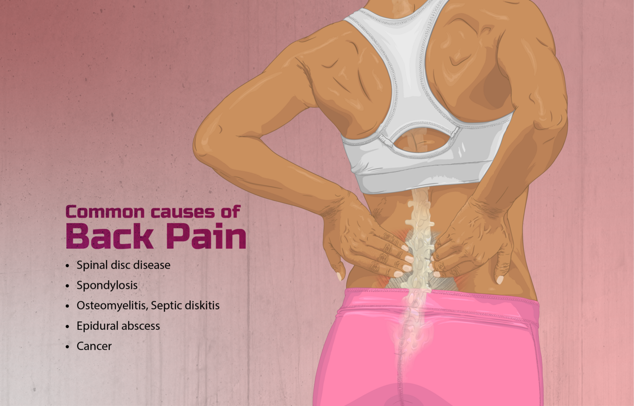 Back pain