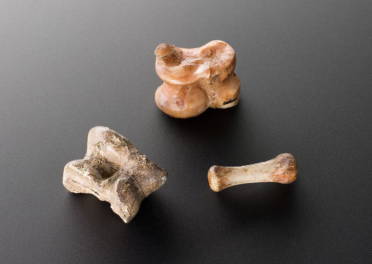 Bone pain