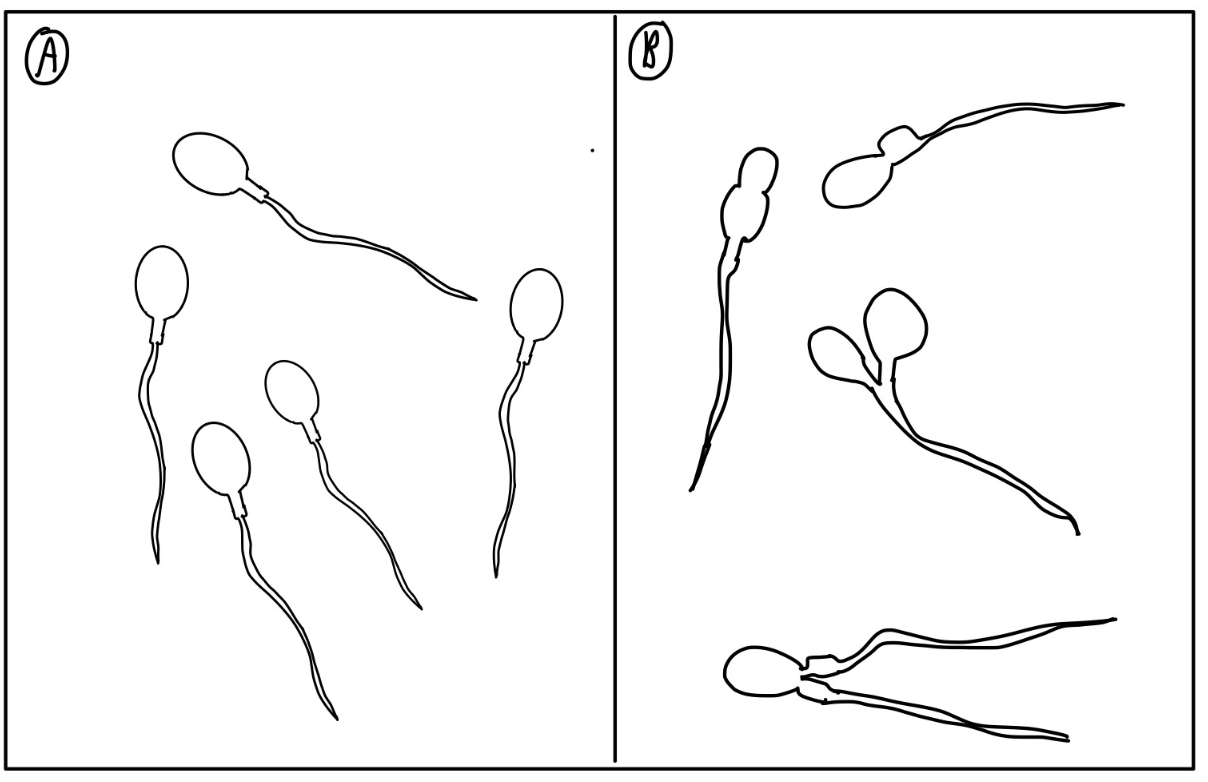 Sperm