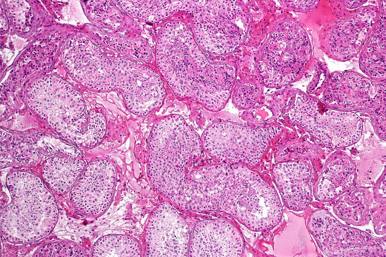 Spermatogenesis