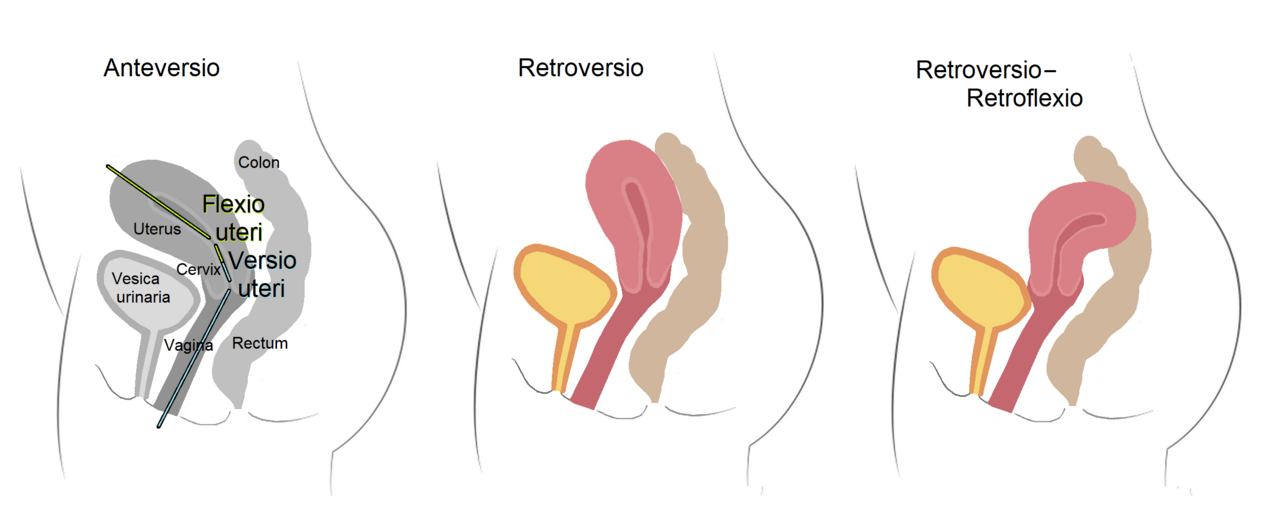 Uterus