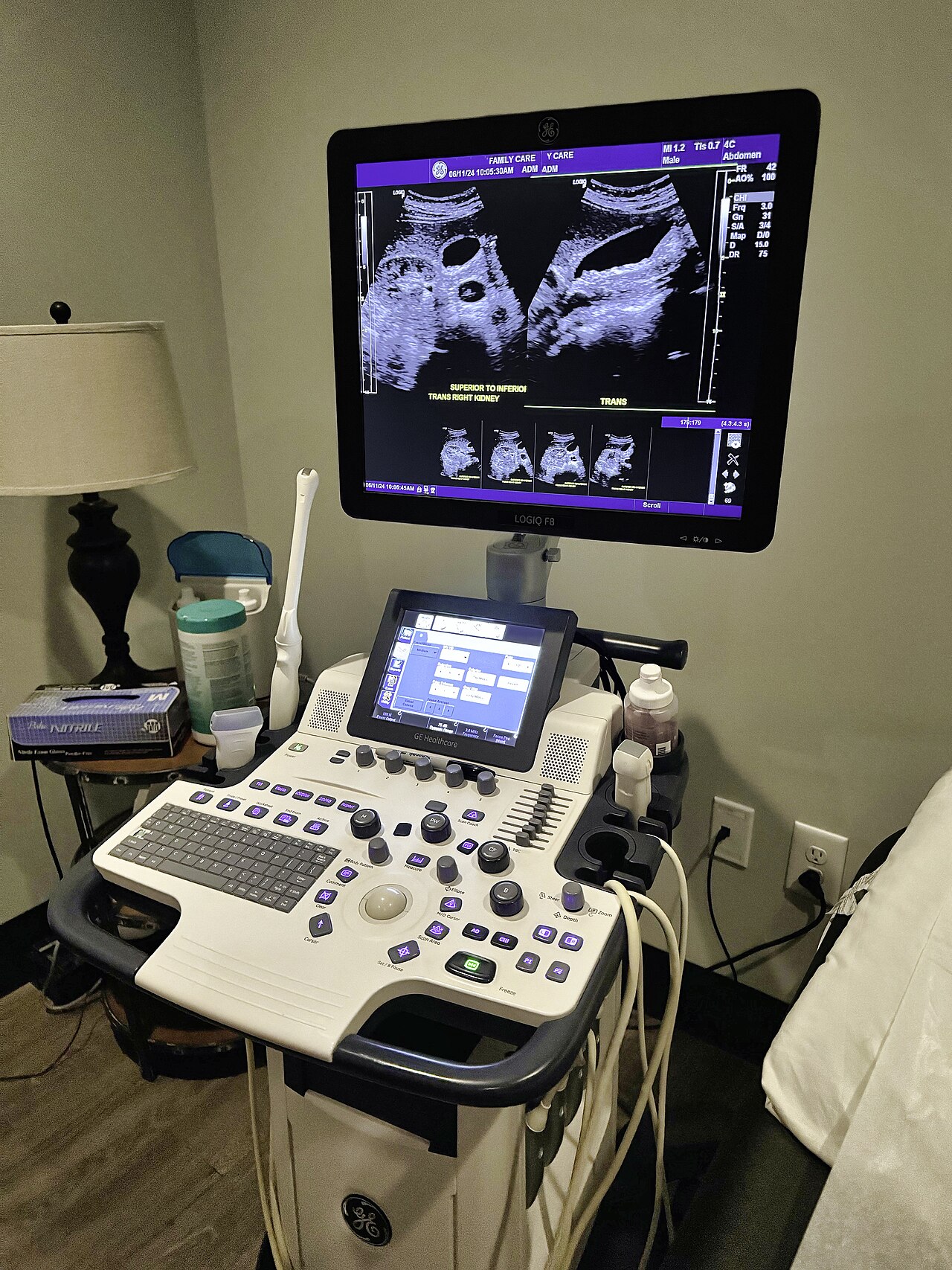 A modern medical ultrasound scanner