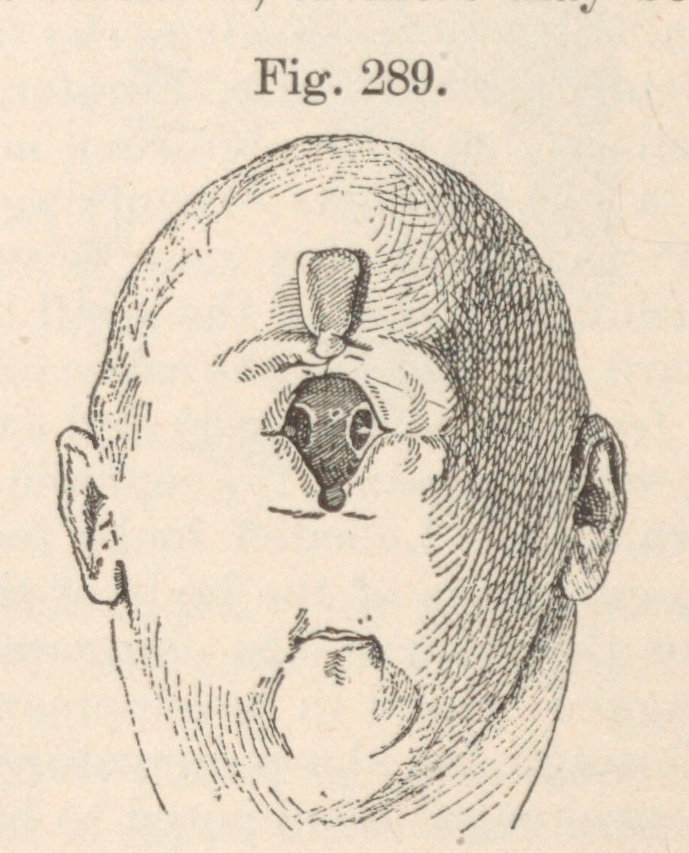 Cyclopia (plant)