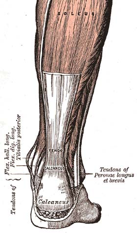 Achilles tendon rupture