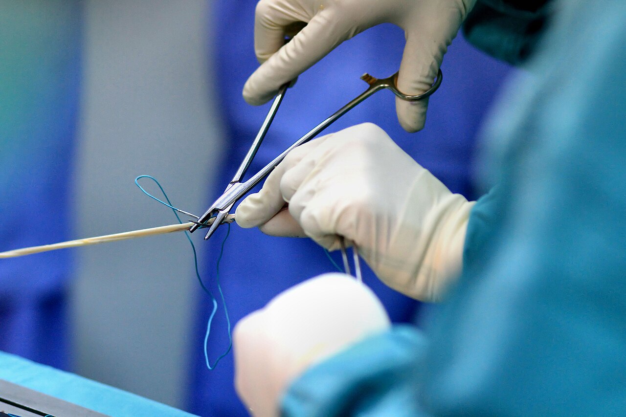 Anterior cruciate ligament injury