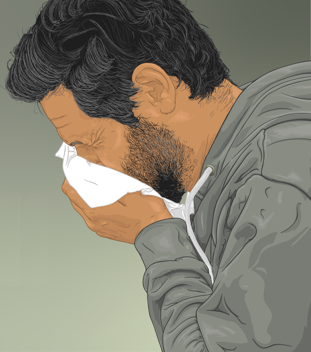 Allergic rhinitis
