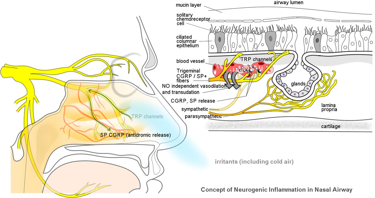 Allergic rhinitis