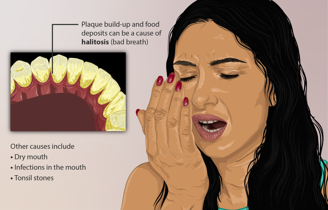 Bad breath