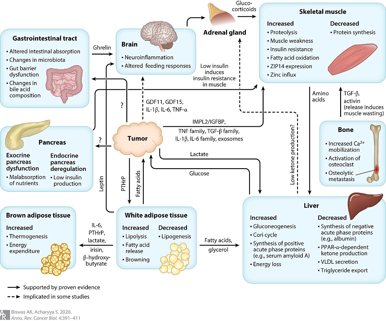 Cancer-associated cachexia diagram