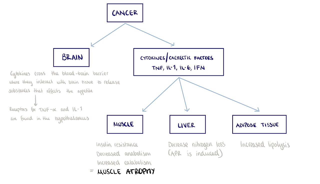 Cancer cachexia 1