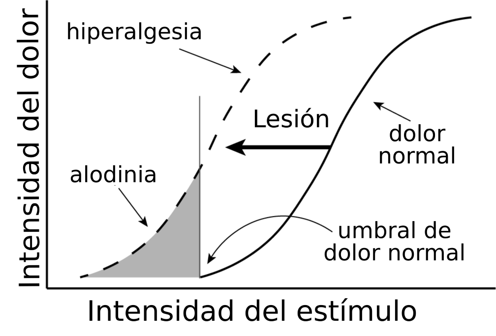Hyperalgesia