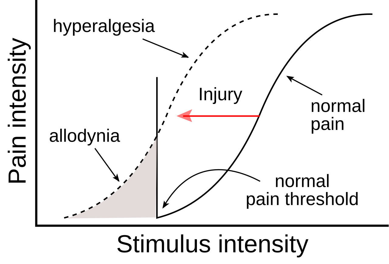 Hyperalgesia