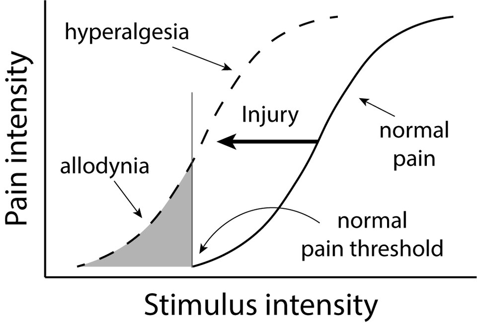 Hyperalgesia