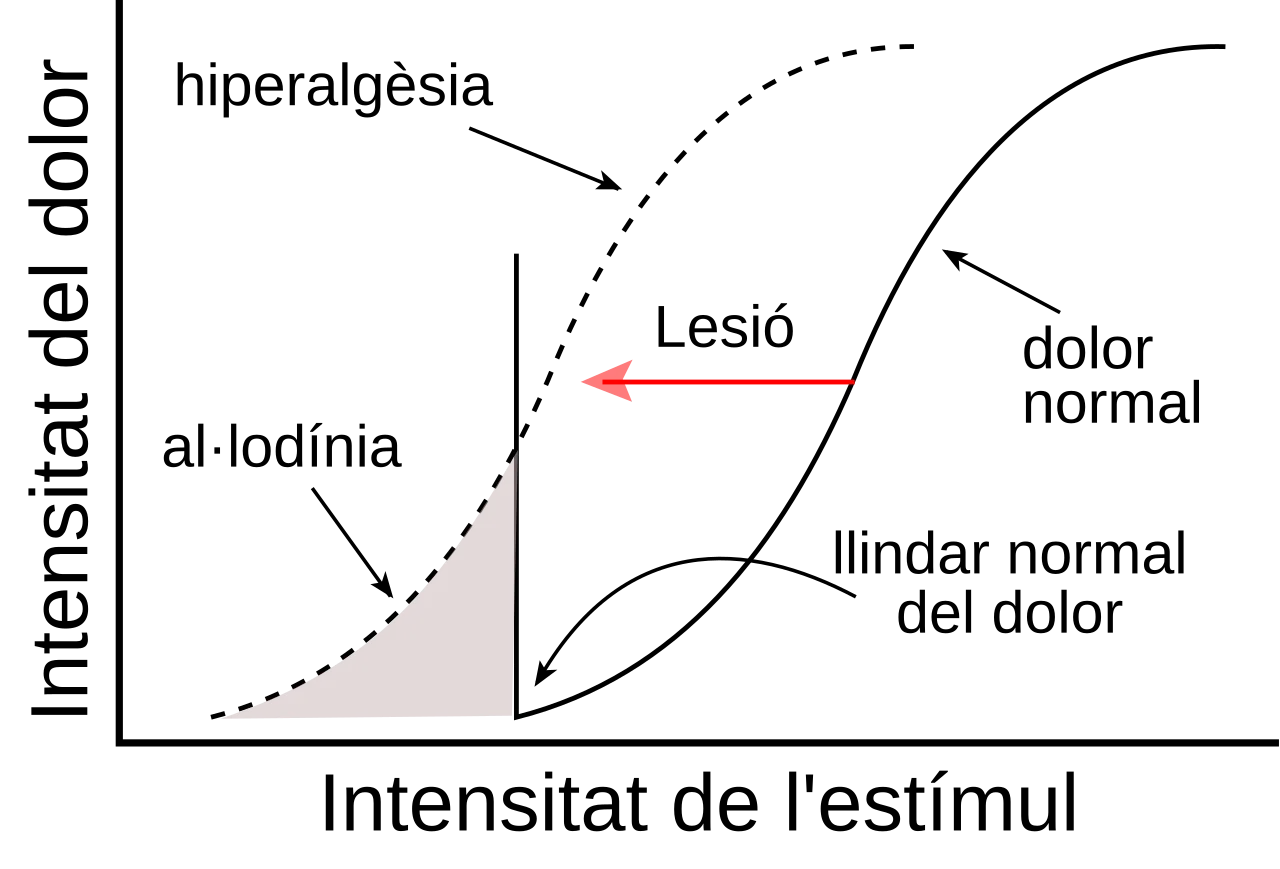 Hyperalgesia