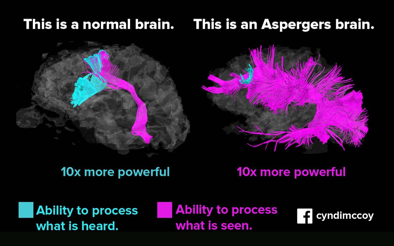 Asperger syndrome