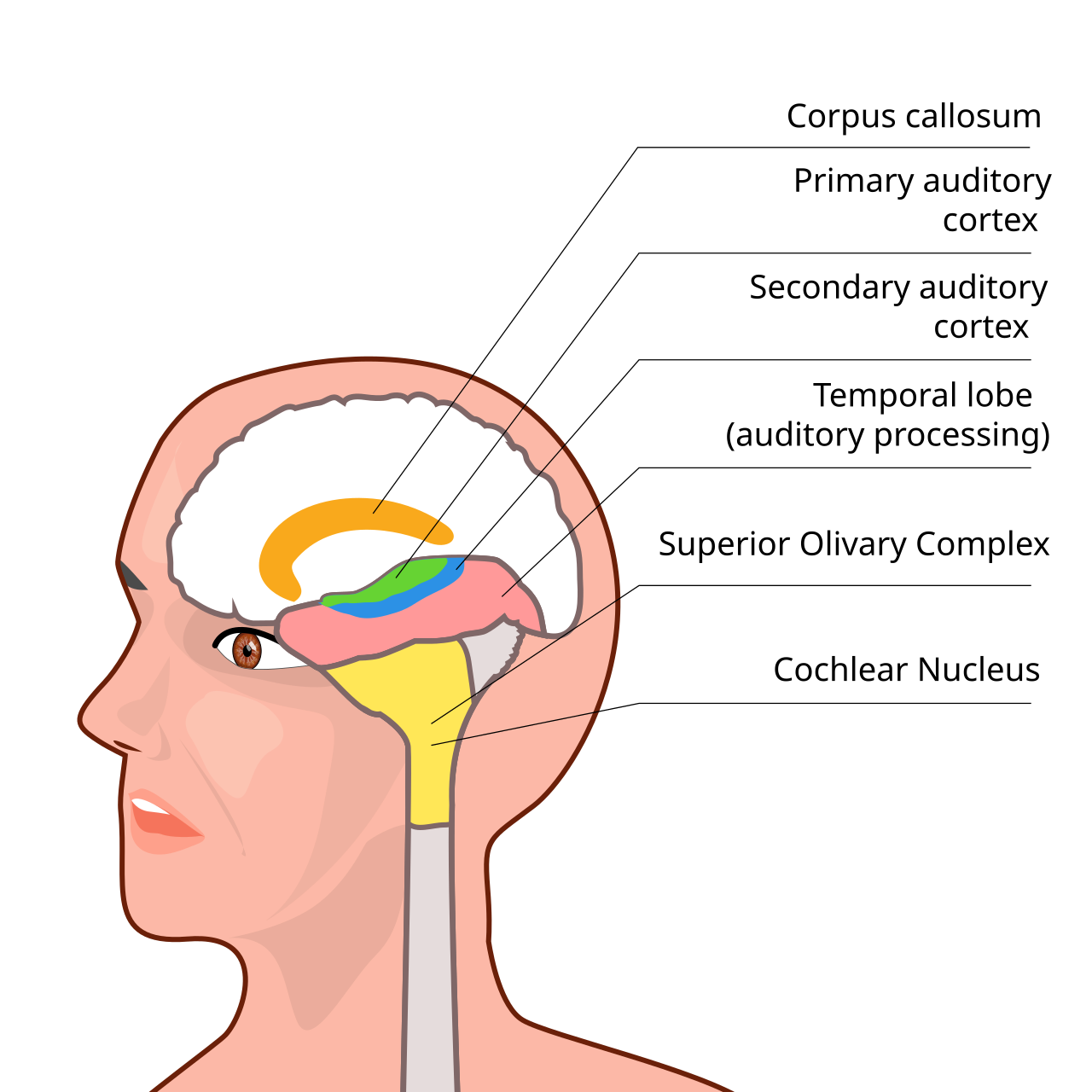Auditory processing disorder