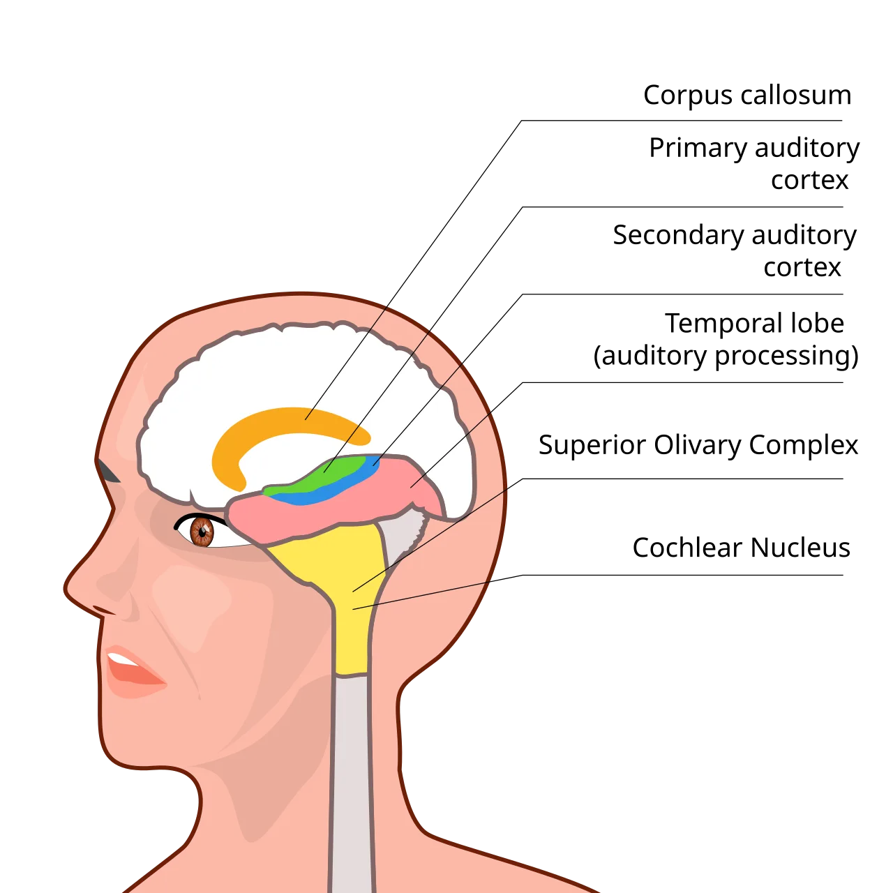 Auditory processing disorder