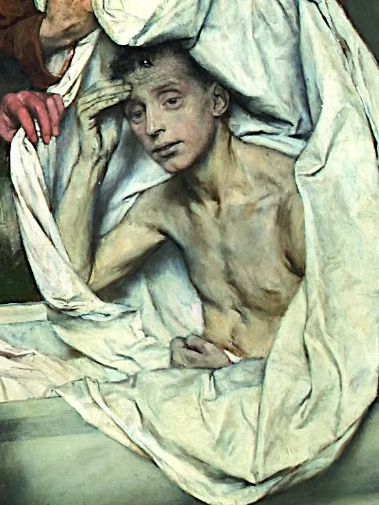 Lazarus
