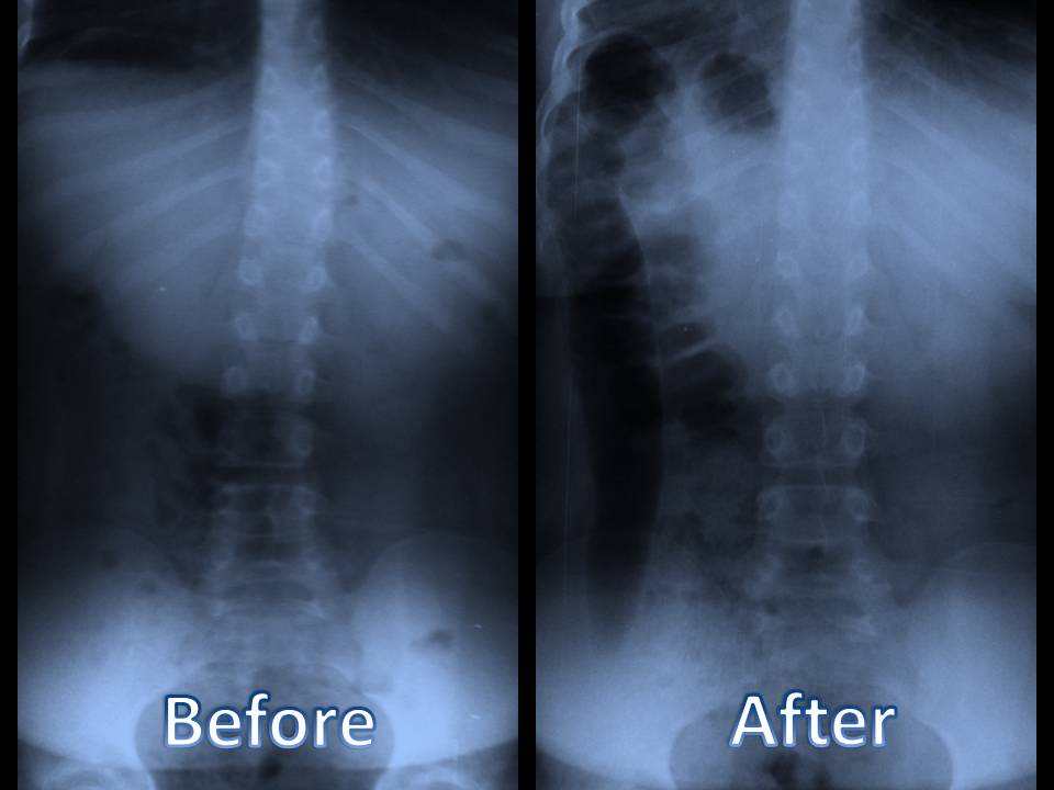 Chiropractic