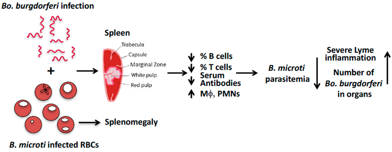 Babesiosis