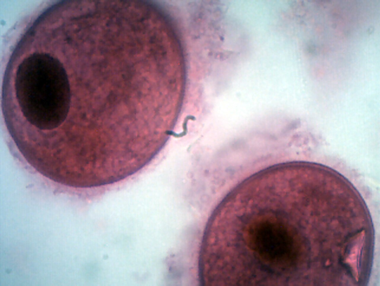 Balantidium coli