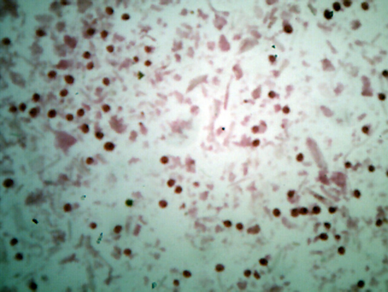 Balantidium coli