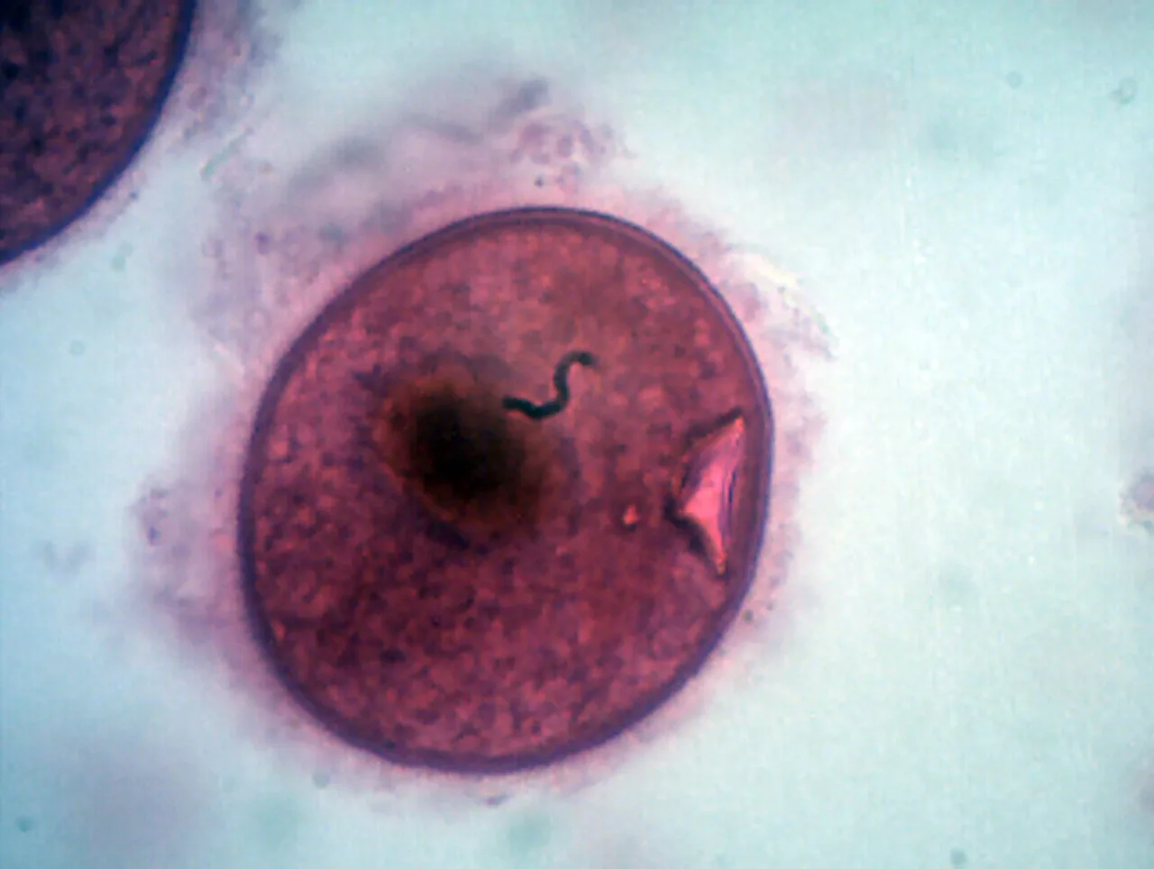 Balantidium coli